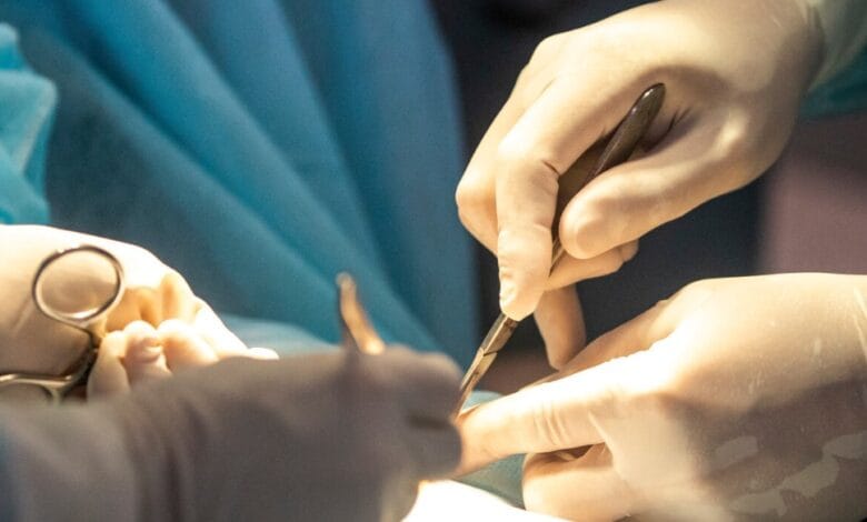 Una apuesta por la salud: El Hospital Posadas ahora realiza cirugías más precisas y menos invasivas para tratar el cáncer de mama