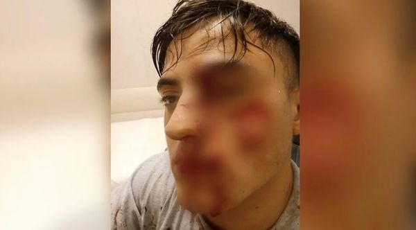 Repudio y temor de la familia del pibe golpeado en el boliche Roca Bruja por una decisión judicial